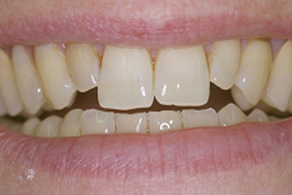  Abb.3: Schlussbefund, Enface, Gesamtbild