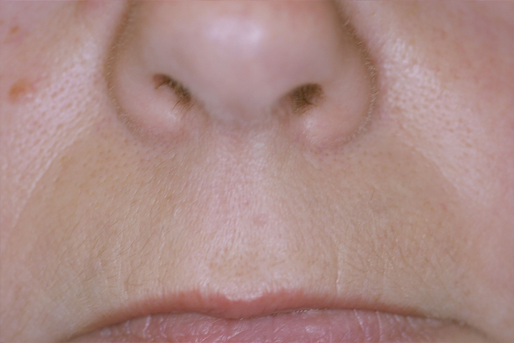 Schlussbefund nach 12 Tagen